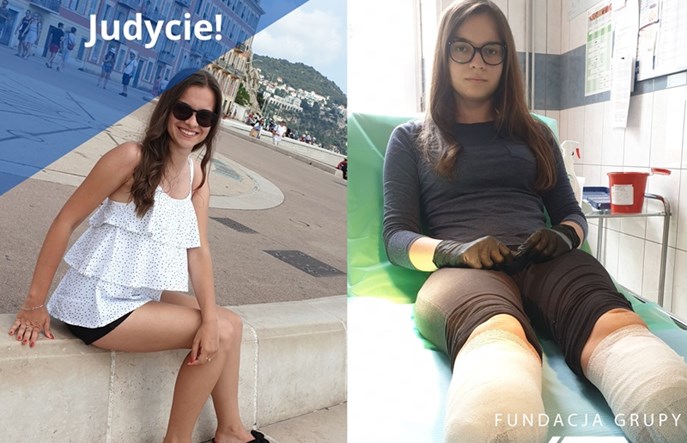 Kolejarze, liczymy na Was! Pomożmy Judycie